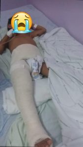 Menino teve costelas e fêmur fraturados Foto: Cortesia
